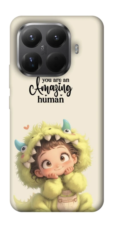Чохол на Xiaomi 15T Pro You are amazing фото 1 з 1