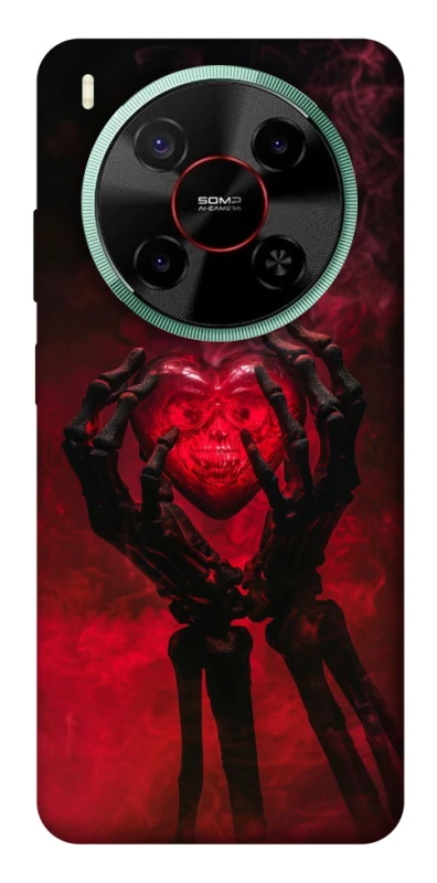 Чохол на ZTE Nubia V70 Max Heart in the hands of a skeleton фото 1 з 1