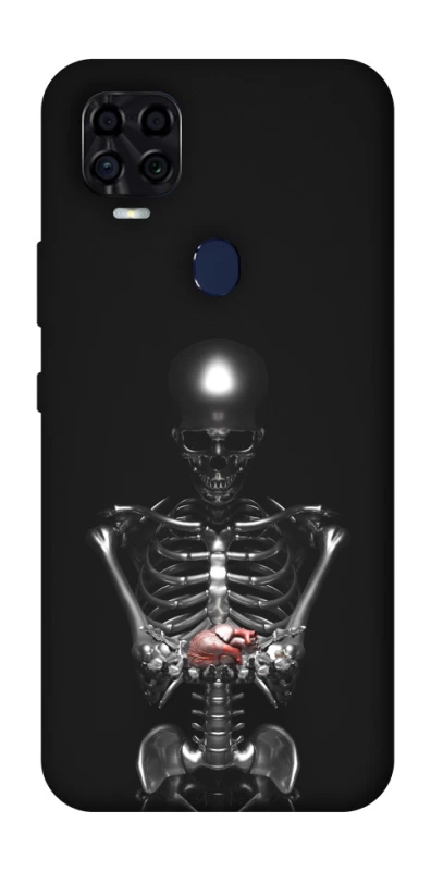Чохол на ZTE Blade v2020 Скелетон фото 1 з 1