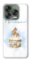 Чохол на ZTE Nubia V70 Design Easter ver.8 фото 1 з 1
