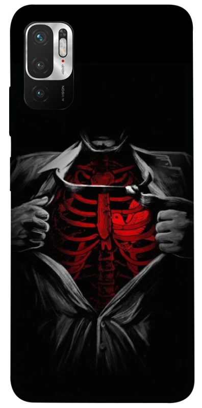 Чохол на Xiaomi Redmi Note 10 5G Skeleton Heart фото 1 з 1