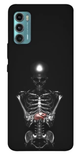 Чехол на Motorola Moto G60 Скелетон фото 1 из 1