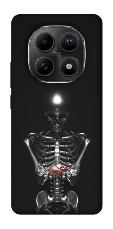 Чохол на Xiaomi Redmi Note 15 5G Скелетон фото 1 з 1