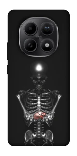 Чохол на Xiaomi Redmi Note 15 5G Скелетон фото 1 з 1