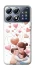 Чехол на Xiaomi POCO X8 Pro Mother's Day ver.1 фото 1 из 1