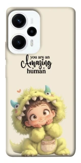 Чохол на Xiaomi Poco F5 / Note 12 Turbo You are amazing фото 1 з 1