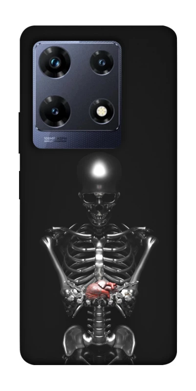 Чохол на Infinix Note 30 Pro Скелетон фото 1 з 1