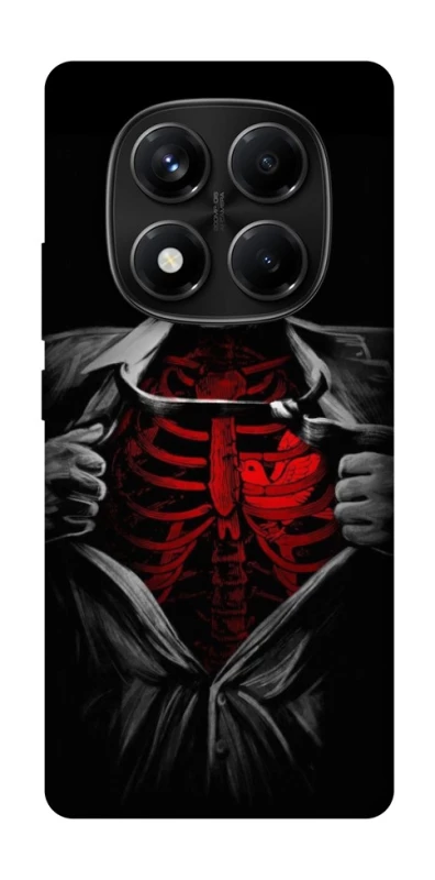 Чохол на Xiaomi Redmi Note 14 Pro 4G Skeleton Heart фото 1 з 1