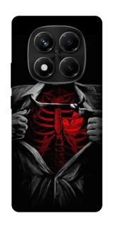 Чохол на Xiaomi Redmi Note 14 Pro 4G Skeleton Heart фото 1 з 1
