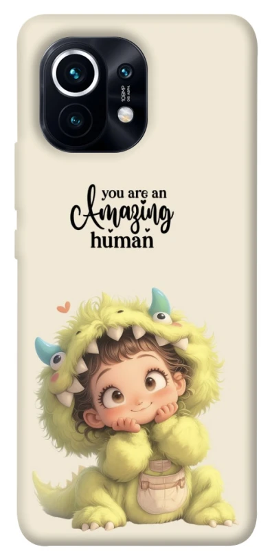 Чохол на Xiaomi Mi 11 You are amazing фото 1 з 1