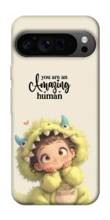 Чохол на Google Pixel 9 Pro You are amazing фото 1 з 1
