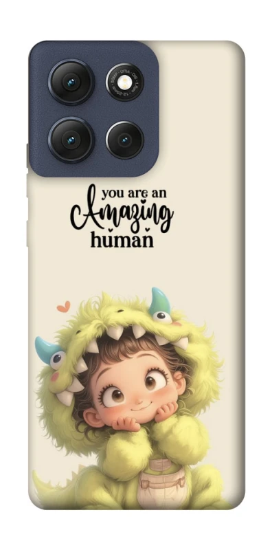 Чохол на Motorola Moto G86 You are amazing фото 1 з 1