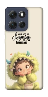 Чохол на Motorola Moto G86 You are amazing фото 1 з 1