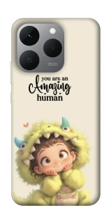 Чохол на Realme 15T You are amazing фото 1 з 1