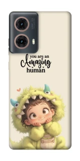 Чохол на Motorola Moto G85 You are amazing фото 1 з 1