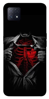 Чохол на Oppo A72 5G / A73 5G Skeleton Heart фото 1 з 1