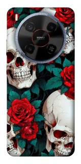 Чехол на ZTE Blade V70 Max skull and rose фото 1 из 1