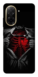 Чохол на Xiaomi Redmi A5 (Europe version) Skeleton Heart фото 1 з 1