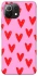 Чохол на Xiaomi Mi 11 Lite Red hearts 2 фото 1 з 1