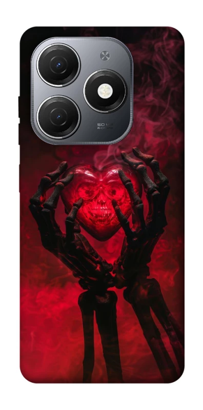Чохол на TECNO Spark 20 Heart in the hands of a skeleton фото 1 з 1