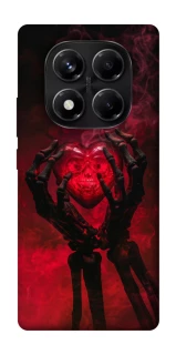 Чехол на Xiaomi Redmi Note 14 Pro 5G Heart in the hands of a skeleton фото 1 из 1