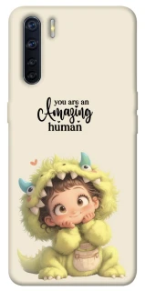 Чехол на Oppo A91 You are amazing фото 1 из 1