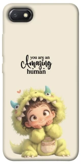 Чохол на Xiaomi Redmi 6A You are amazing фото 1 з 1