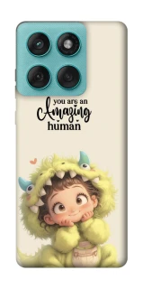 Чехол на Motorola Edge 60 Fusion You are amazing фото 1 из 1