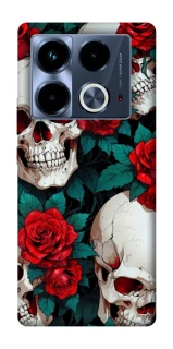 Чохол на Infinix Note 40 4G skull and rose фото 1 з 1