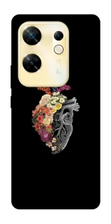 Чохол на Infinix Zero 30 4G Heart with flowers фото 1 з 1