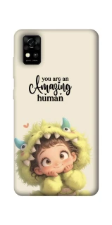 Чохол на ZTE Blade A31 You are amazing фото 1 з 1