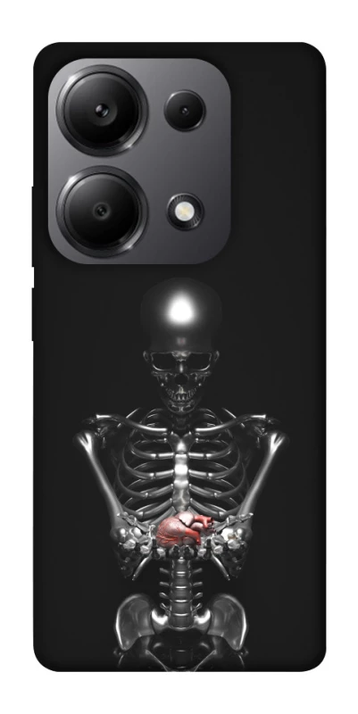 Чехол на Xiaomi Redmi Note 13 Pro 4G Скелетон фото 1 из 1