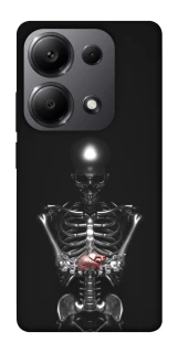 Чехол на Xiaomi Redmi Note 13 Pro 4G Скелетон фото 1 из 1