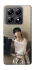 Чехол на Xiaomi 14T Pro Jungkook v2 - BTS фото 1 из 1