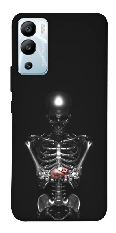 Чохол на Infinix Hot 12i Скелетон фото 1 з 1