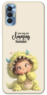 Чехол на TECNO Spark 8P You are amazing фото 1 из 1