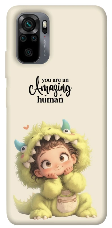 Чохол на Xiaomi Redmi Note 10 / Note 10s You are amazing фото 1 з 1