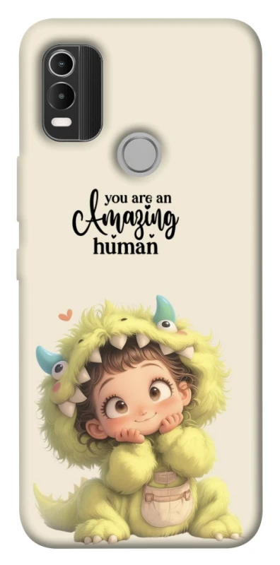 Чохол на Nokia C21 Plus You are amazing фото 1 з 1