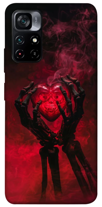 Чохол на Xiaomi Poco M4 Pro 5G Heart in the hands of a skeleton фото 1 з 1