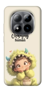 Чохол на Xiaomi Redmi Note 15 Pro 5G You are amazing фото 1 з 1