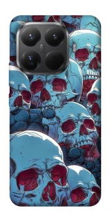 Чехол на Xiaomi 15T Pro Skulls v2 фото 1 из 1