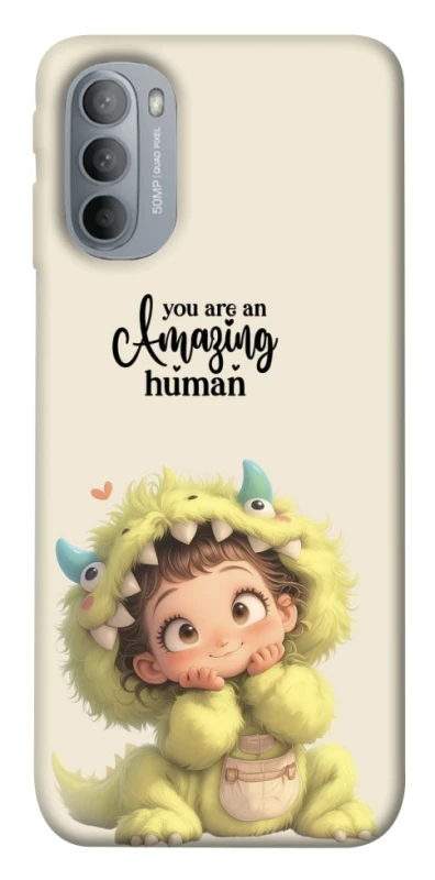 Чехол на Motorola Moto G31 You are amazing фото 1 из 1