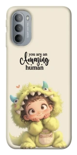 Чехол на Motorola Moto G31 You are amazing фото 1 из 1