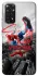 Чохол на Xiaomi Redmi Note 11 (Global) / Note 11S Spider Man ver.1 фото 1 з 1