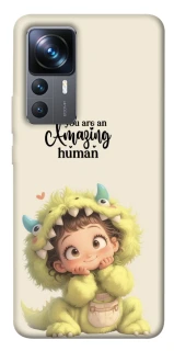 Чехол на Xiaomi 12T / 12T Pro You are amazing фото 1 из 1