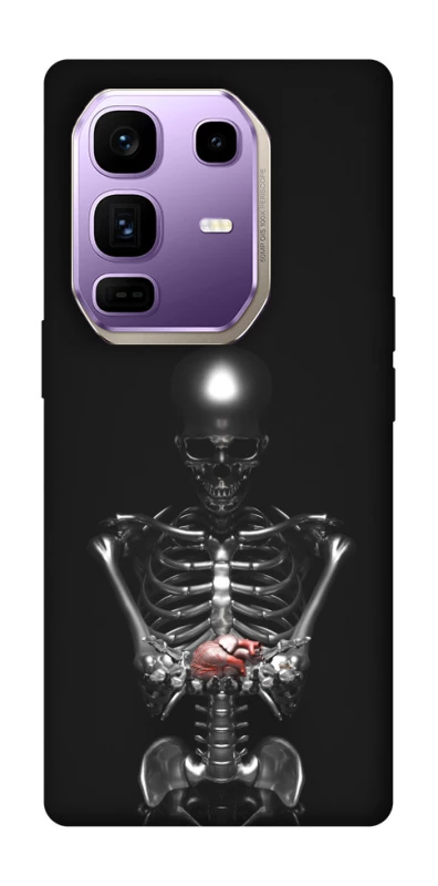 Чохол на Infinix Note 50 Pro+ Скелетон фото 1 з 1