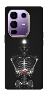 Чохол на Infinix Note 50 Pro+ Скелетон фото 1 з 1