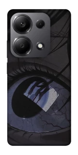 Чохол на Xiaomi Redmi Note 13 Pro 4G Eye фото 1 з 1