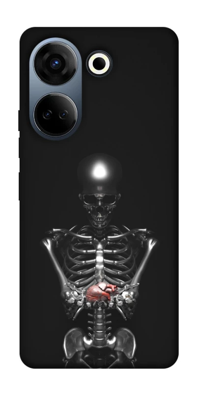 Чохол на TECNO Camon 20 Pro (CK7n) Скелетон фото 1 з 1