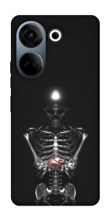 Чохол на TECNO Camon 20 Pro (CK7n) Скелетон фото 1 з 1